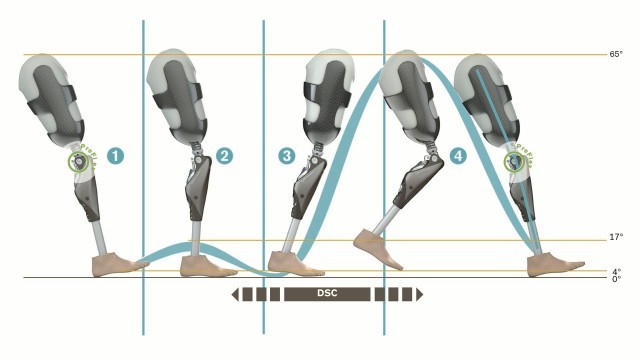 Как научиться ходить на протезе
