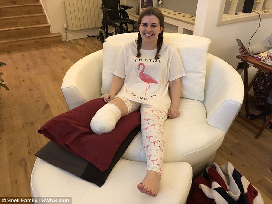 26-летняя женщина решила ампутировать правую ногу после того, как поняла, что ее перелом не заживет
