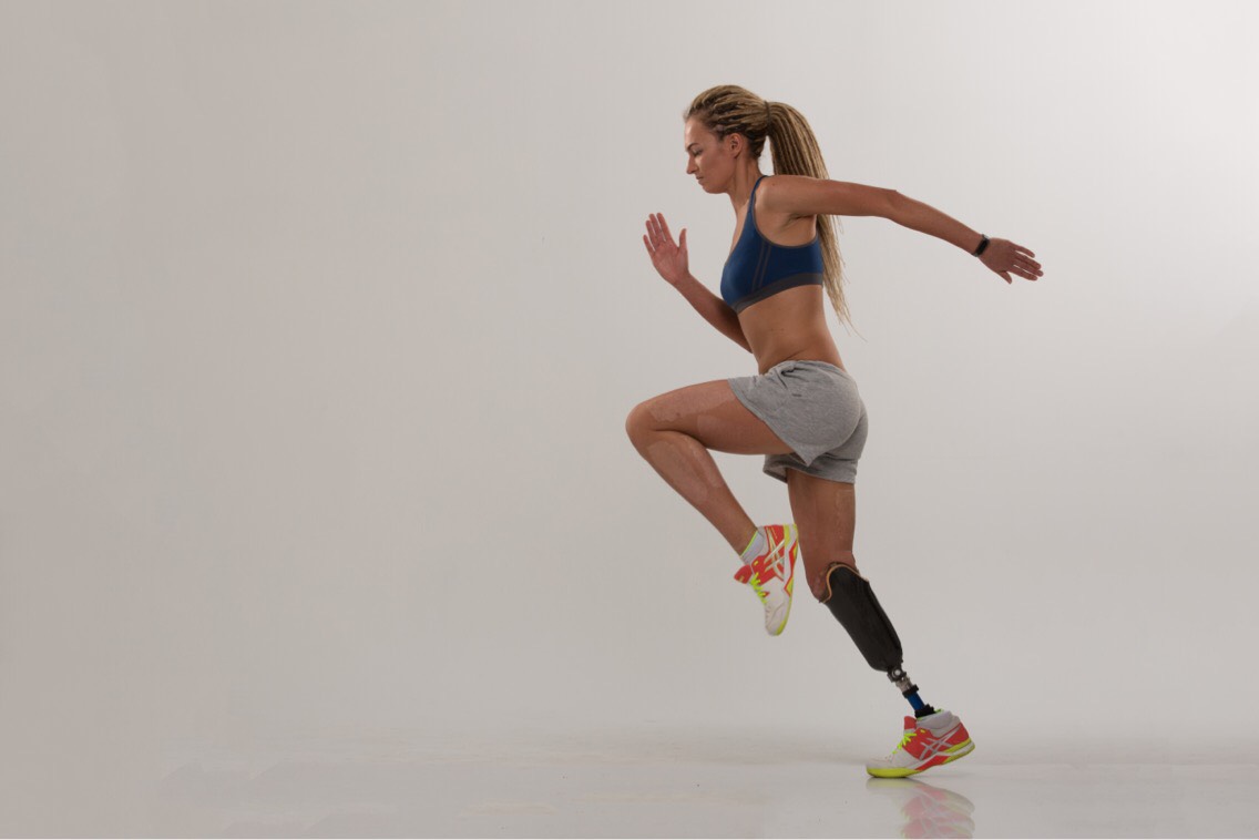 Поэтому девушка приняла нестандартное решение ампутировать ногу до колена — ведь протез позволил продолжать заниматься теннисом и бегом.