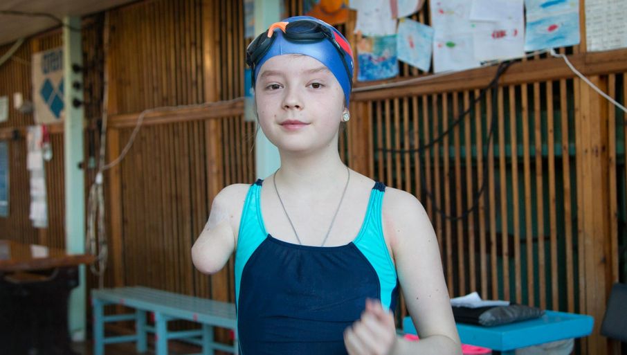 Как живёт девочка с биоэлектрическим протезом руки