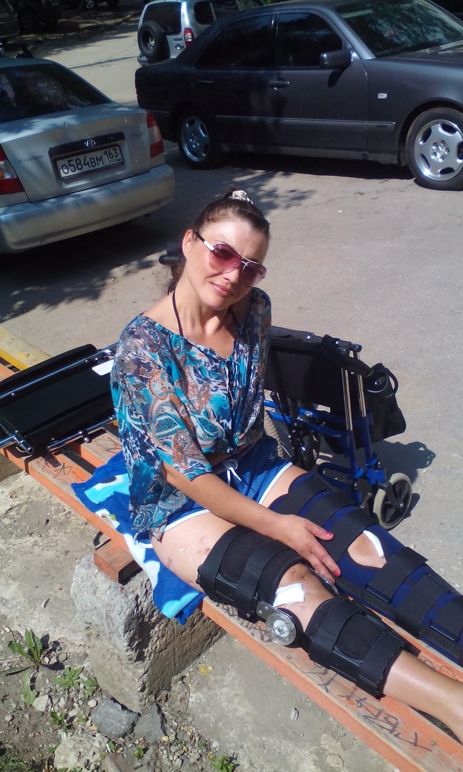 Там мне диагностировали остеомиелит. А еще через какое-то время врач-ортопед поликлиники №1 заявил: «вам уже ничего не поможет, только ампутация».