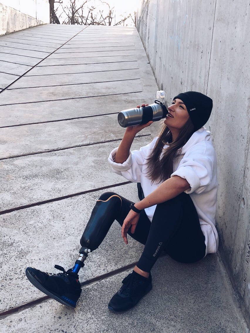 Очень многие думают, что после ампутации жизнь закончена, но это не так