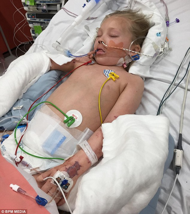 Brogan-Lei Partridge осталась сражающейся за свою жизнь после развития менингита B во время семейного праздника для своего родителя,