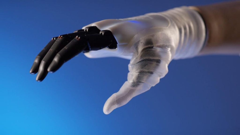 протез руки