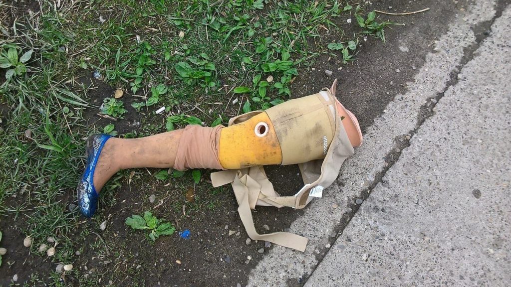 женский протез ноги