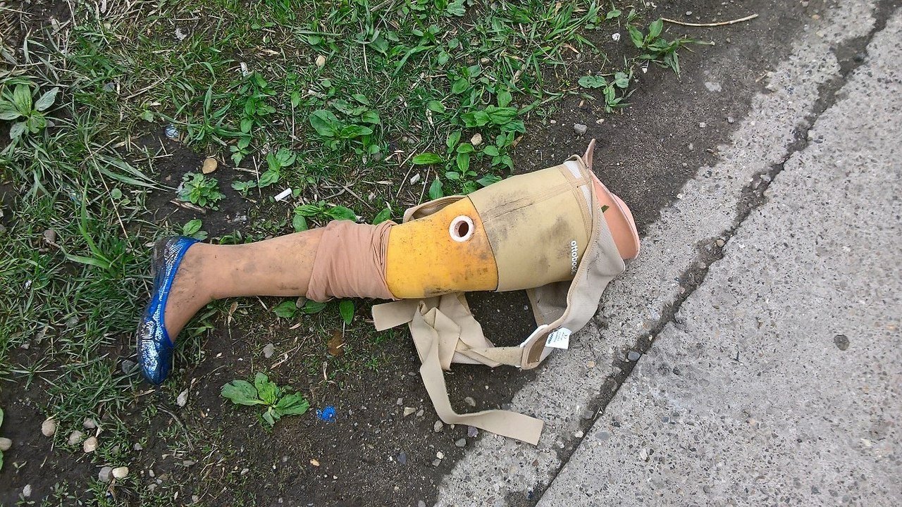 женский протез ноги