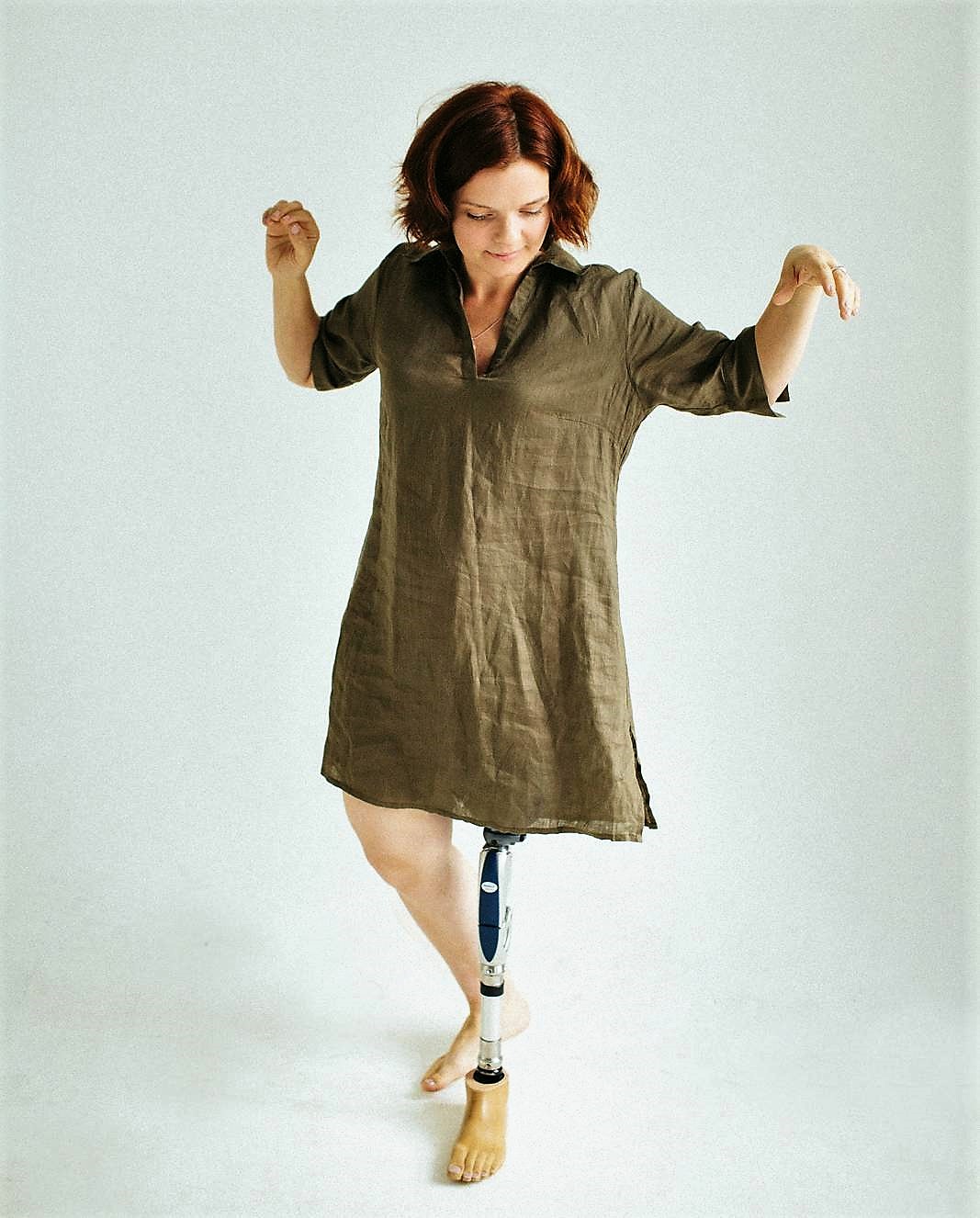 — Я из Гомеля, в Минск переехало 6 лет назад. Когда мать была беременна мной, после одного из УЗИ врачи сказали, что плод расположен неправильно и предложили сделать аборт. Но мать отказалась. Я родилась с целым «букетом» патологий левой ноги. Одно время остановку развития кости ноги объясняли тем, что ее обвила пуповина. Другие специалисты говорили, что причина в генетических изменениях. В результате, у меня хоть и было две ноги, но левая — без большеберцовой кости. Когда мне исполнилось полгода, в центре травматологии и ортопедии сделали первую операцию, чтобы как-то спасти ситуацию. Потом еще раз 8 ставили аппарат Илизарова — вытягивали ногу, как могли, засовывая туда спицы, гипсовали и делали вытяжку.