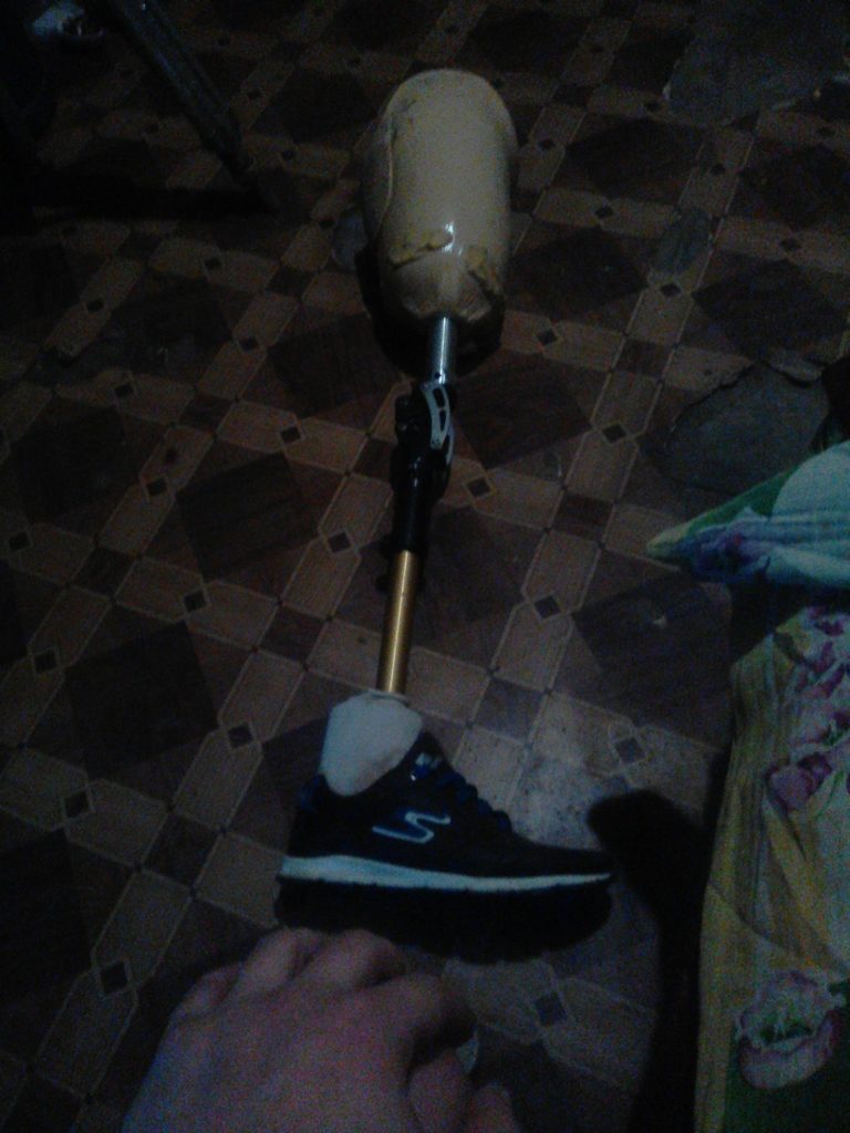 Продам протез правого бедра