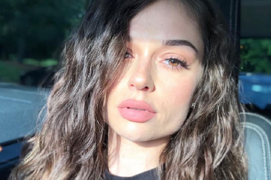 Tessa Snyder — 29-летняя модель, которой в детстве ампутировали ногу