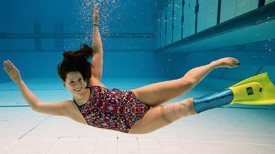 «Я проснулась, а моей ноги уже не было»