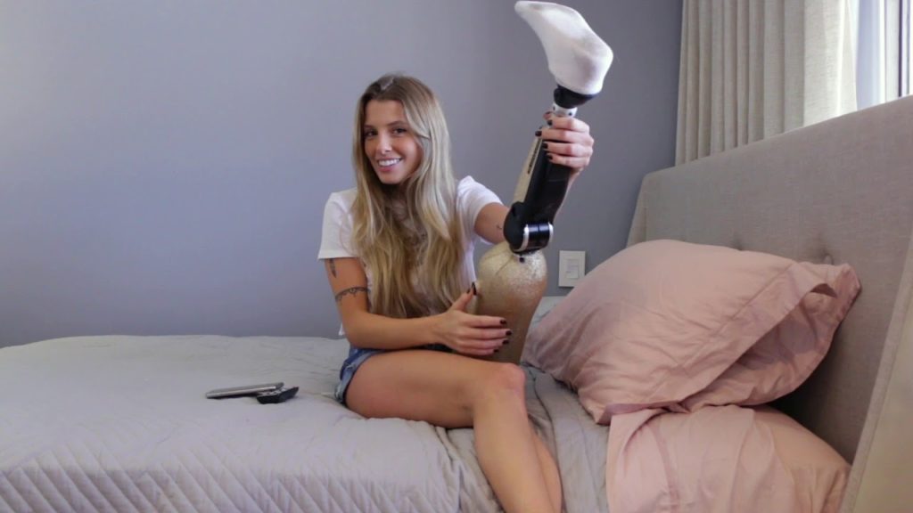 «Я хочу быть моделью для других инвалидов-ампутантов»