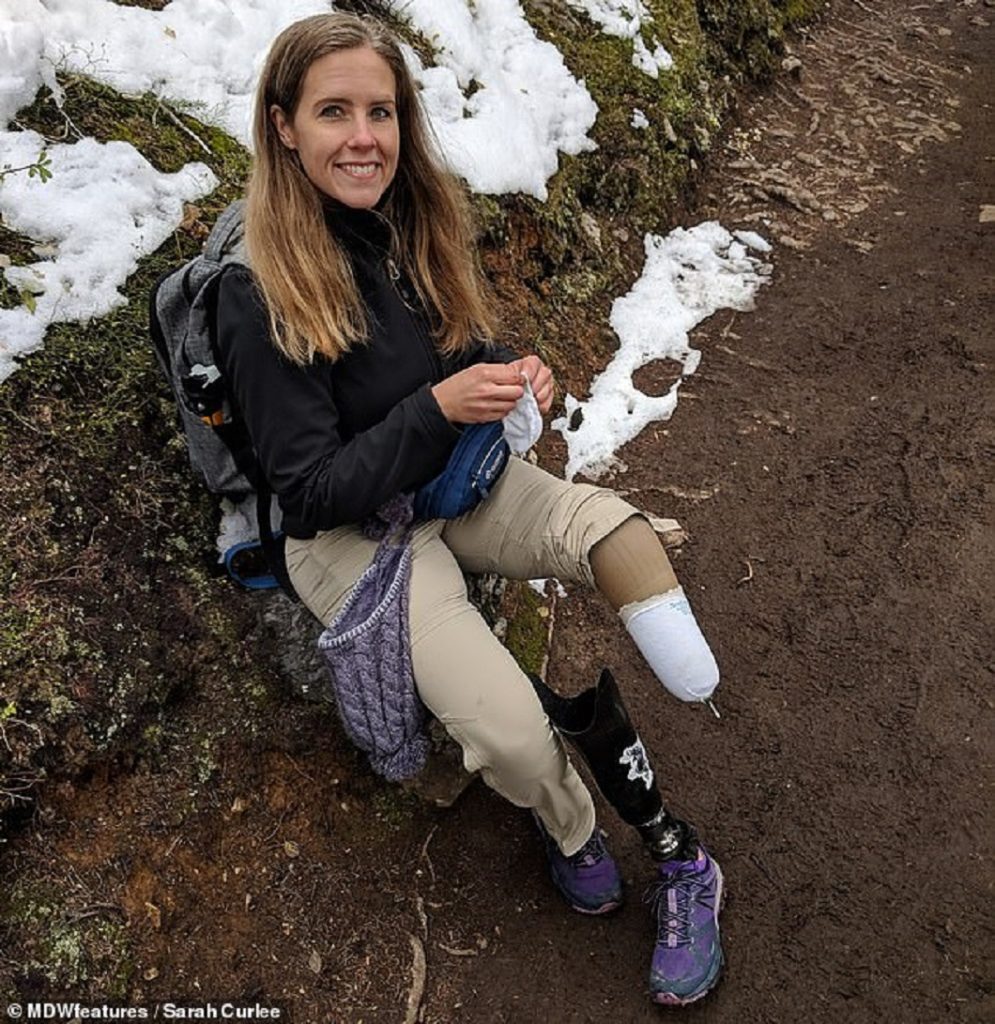 Женщина, перенесшая инсульт всего в 27 лет, решила ампутировать ногу