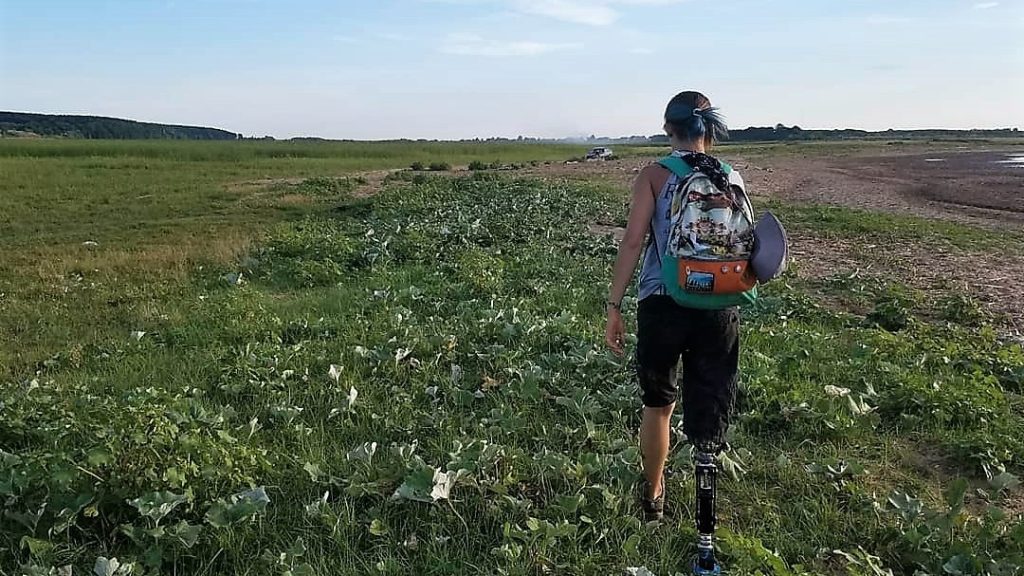 «А что с ногой?»