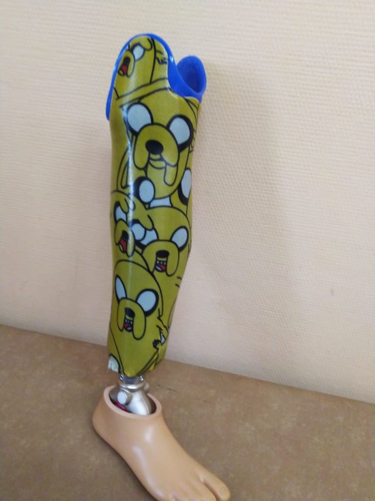 Продам протез правой голени