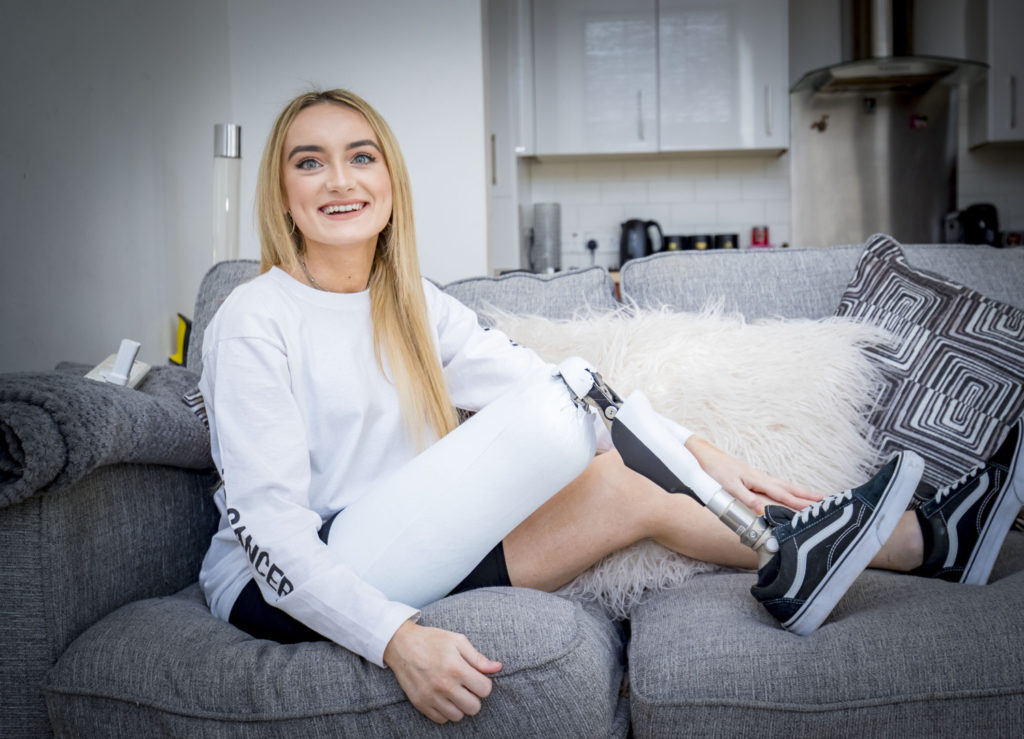 Девушка стала моделью после того, как редкая форма рака привел её к ампутации ноги