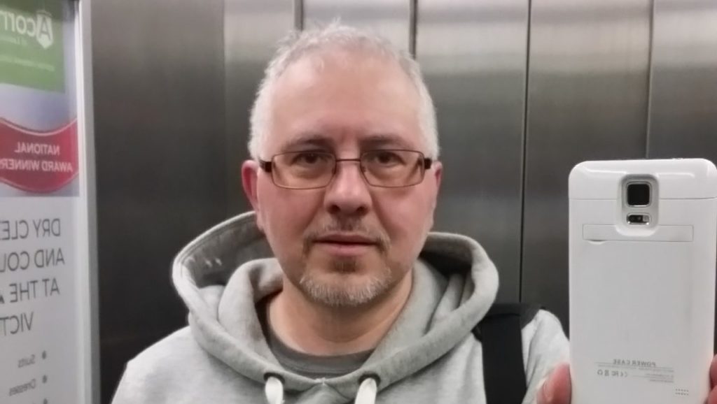 Познакомлюсь с женщиной после ампутации