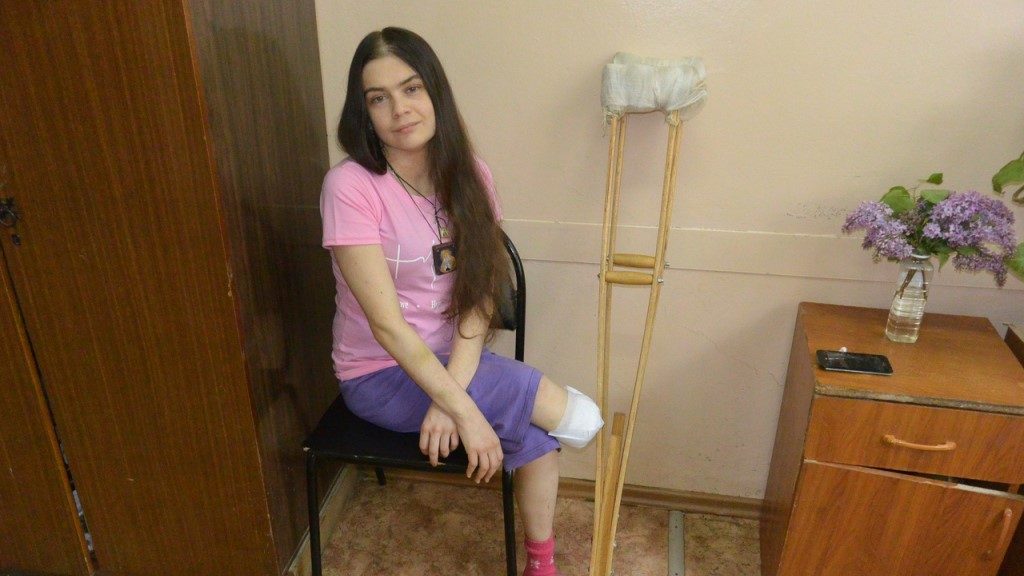 Молодая девушка осталась без ноги из-за перелома