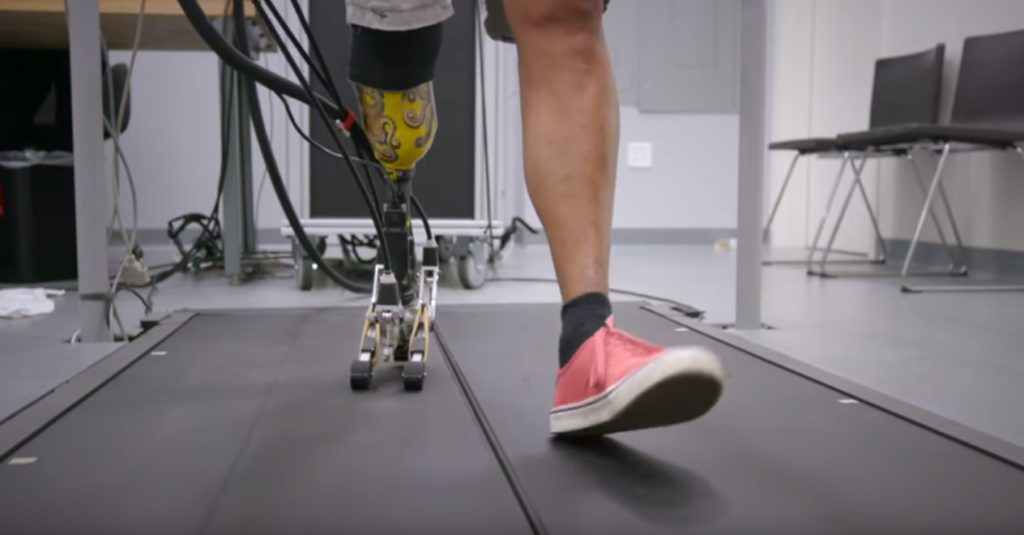 Самая реалистичная ступня протеза