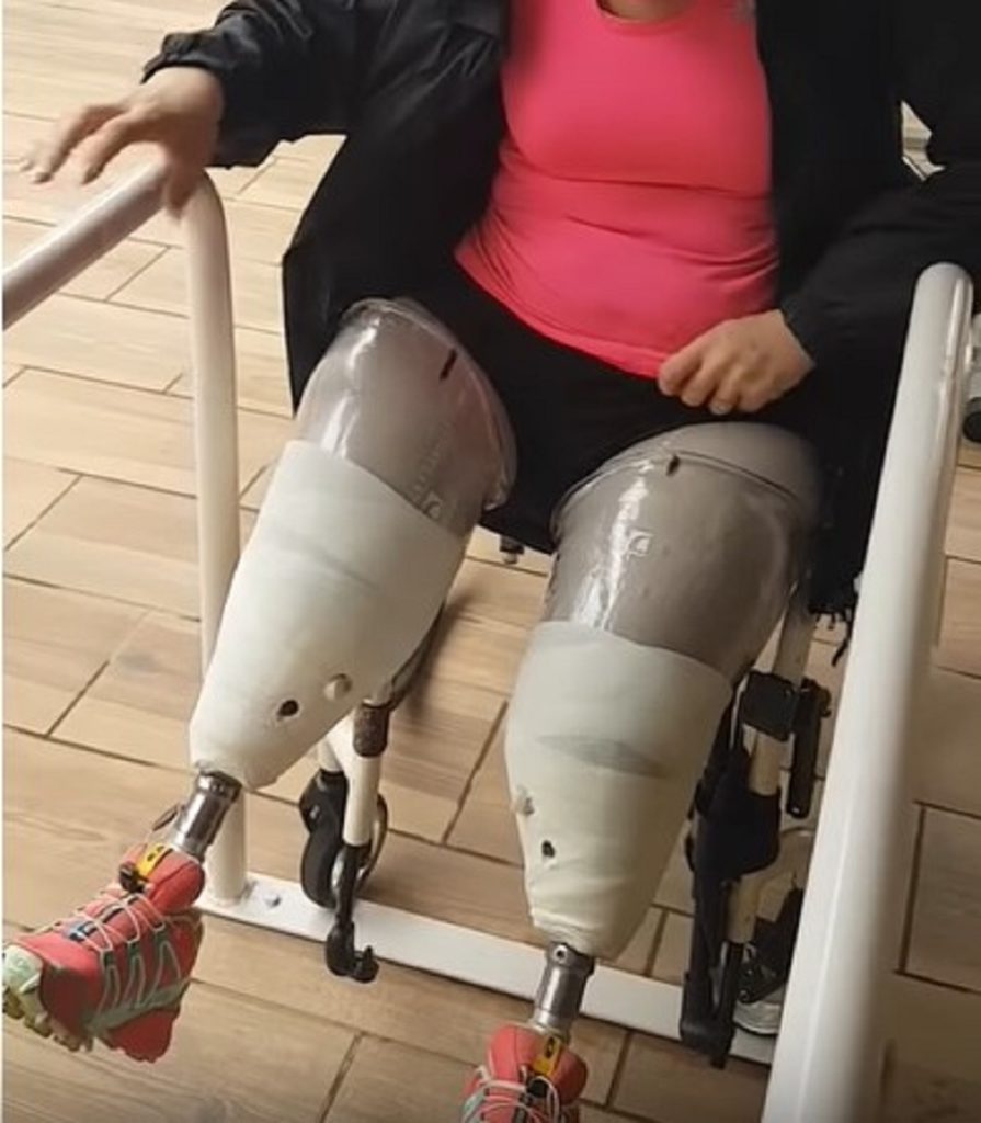 Вступили новые правила обеспечения протезами при первичном протезировании