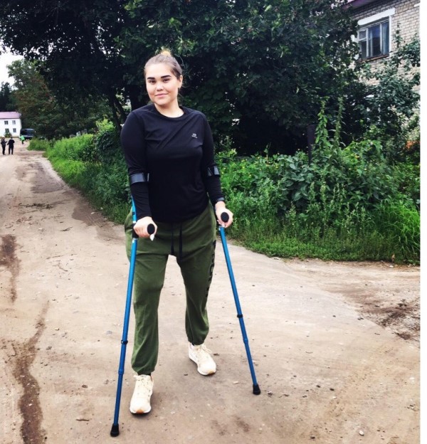 Девушка, потерявшая ноги после аварии, приобрела протезы