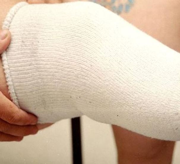 Куплю чулки для ортеза