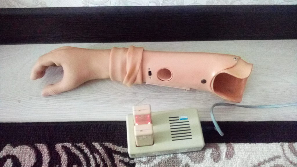 Биоэлектрический протез правой руки