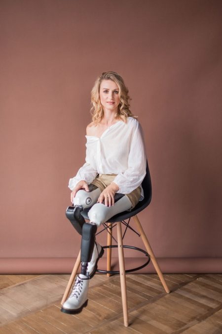 Ирина Мирная ходит на двух протезах бедра…