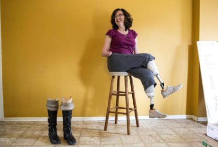 Психологический настрой после ампутации