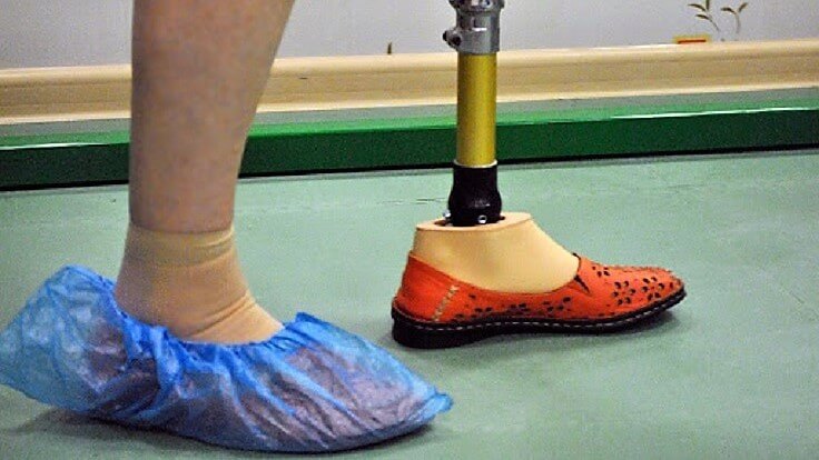 Женщину на протезе без бахил не пустили в развлекательный центр