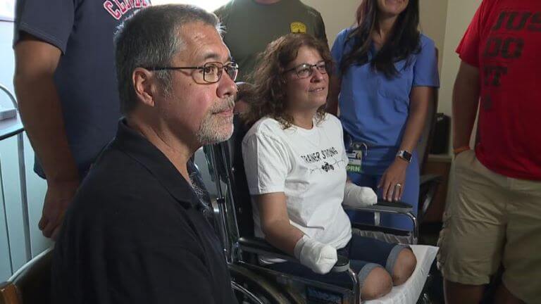 Женщине пришлось частично ампутировать руки и ноги из-за серьезной инфекции