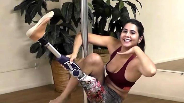 С ампутированной ногой Каяне Карнейро обнаружила страсть к танцам