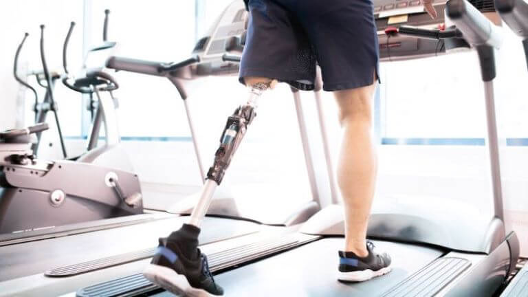 Мужчина на протезе ноги