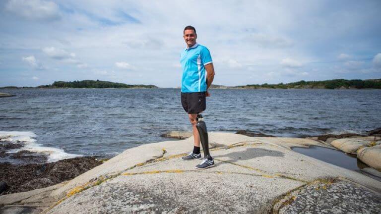 Пользователь с ампутированной конечностью OPRA ™ Implant System