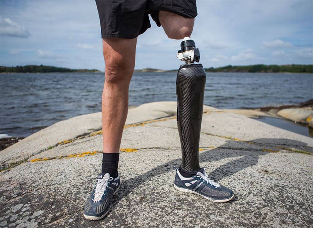 Система протезов с фиксацией на кости