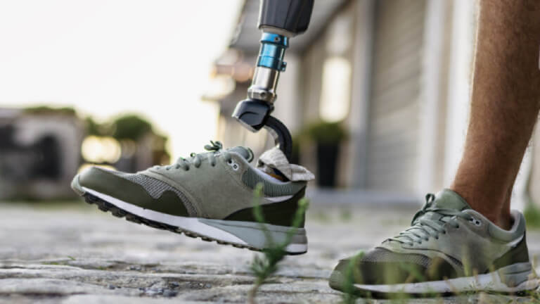 Система имплантатов OPRA