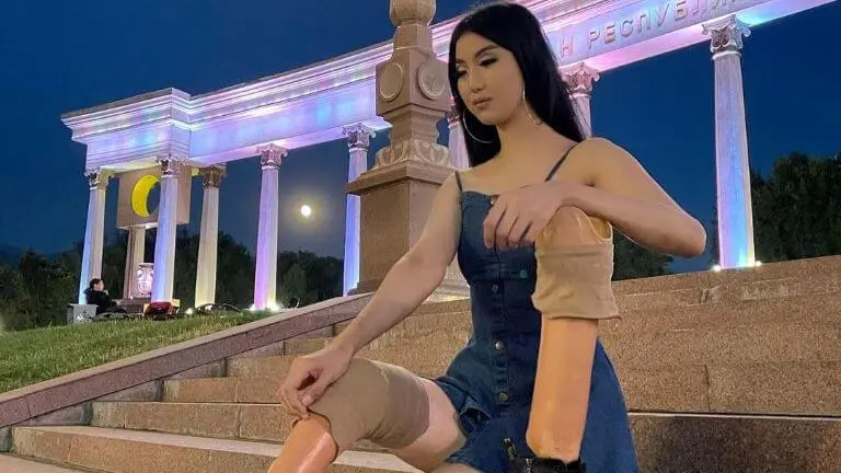 Самал Смахан из Алматы в детстве потеряла обе ноги ниже колен