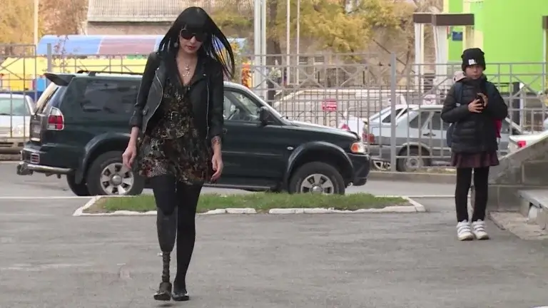 Уфимка, потерявшая в результате страшной аварии ногу