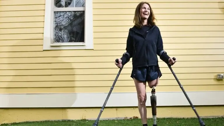 Остеоинтегрированный протез бедра