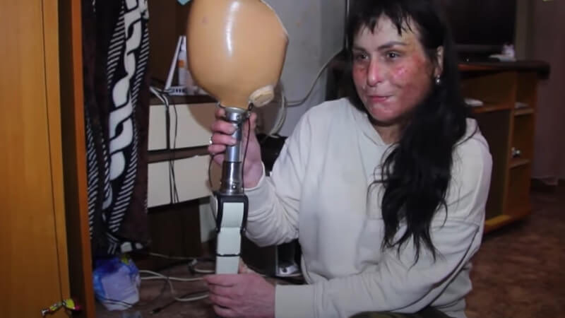 Анастасия Стахеева-женщина без ноги