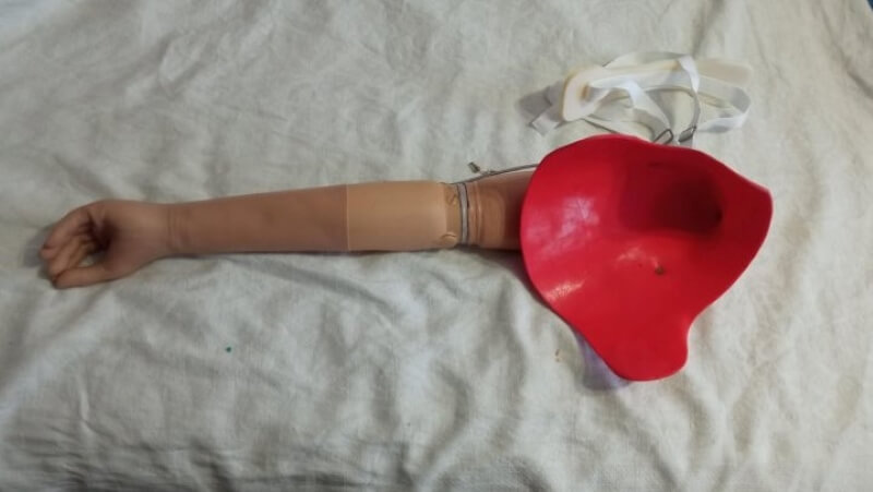 Тяговый протез левой руки