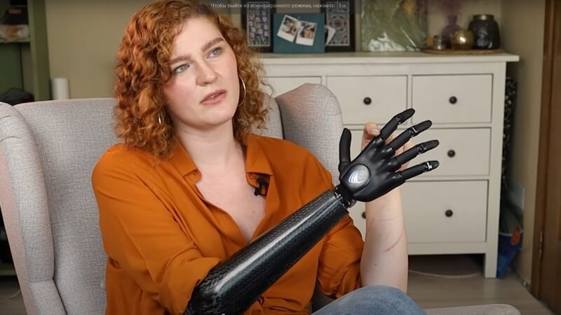 Немецкий бионический протез руки