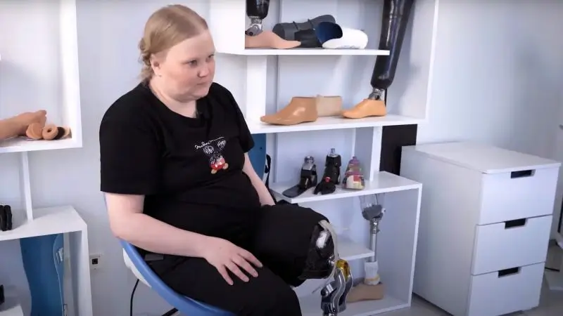 Девушка с протезом ноги