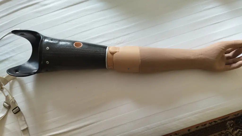 Протез руки