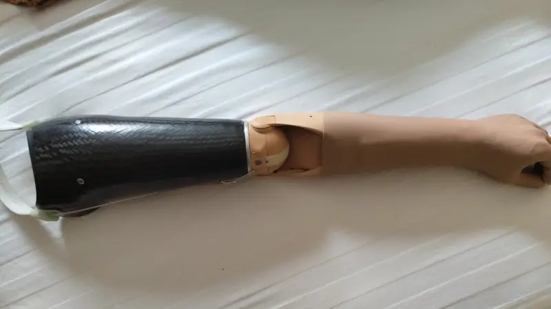 Протез руки