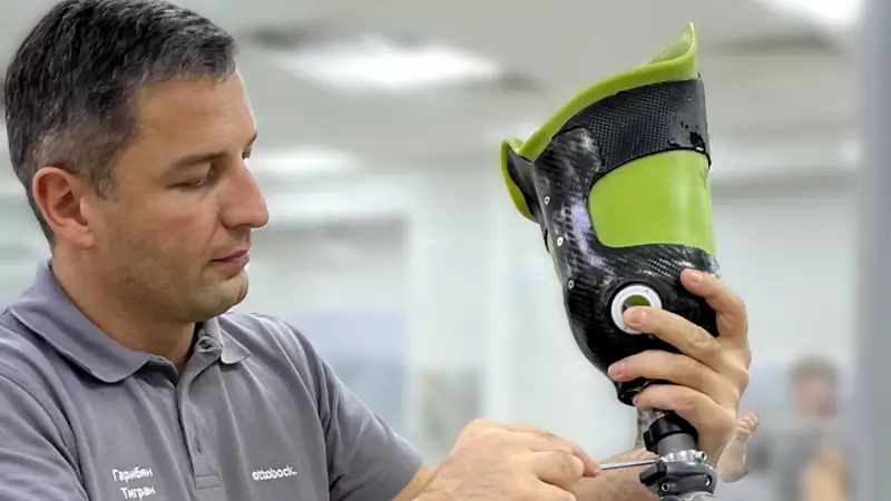 Протезирование конечностей