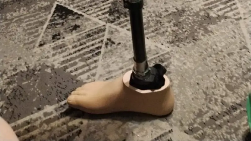 Протез ноги