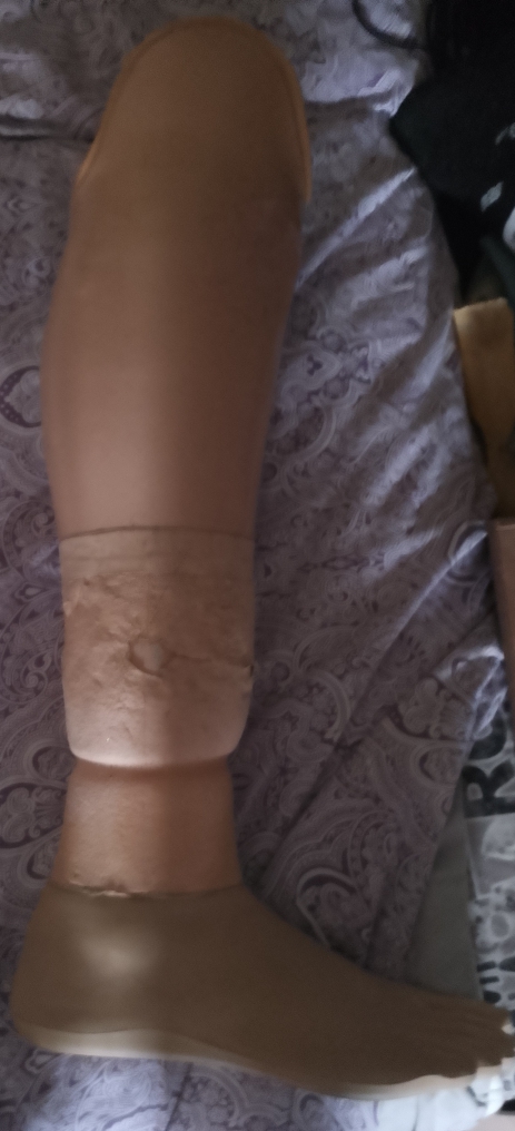 Протез правой ноги