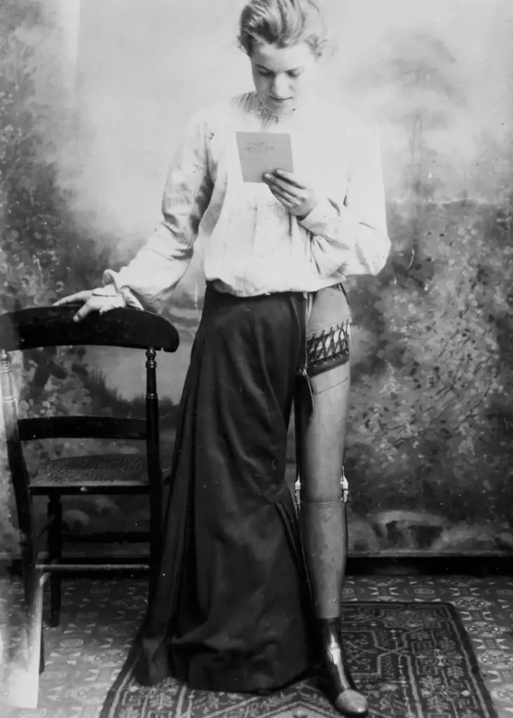 Необыкновенные ранние протезы, изготовленные Джеймсом Гиллингемом