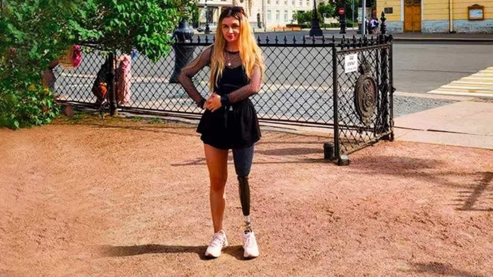 Александра на протезе