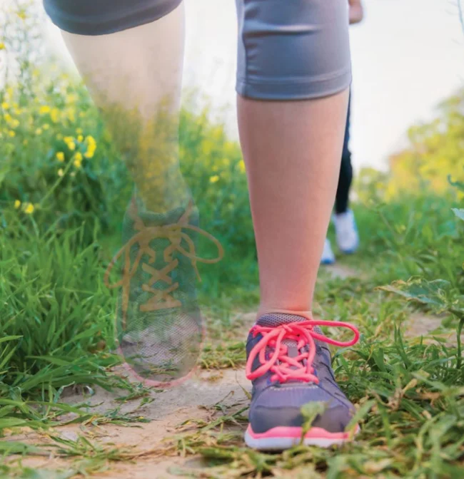 Фантомная боль